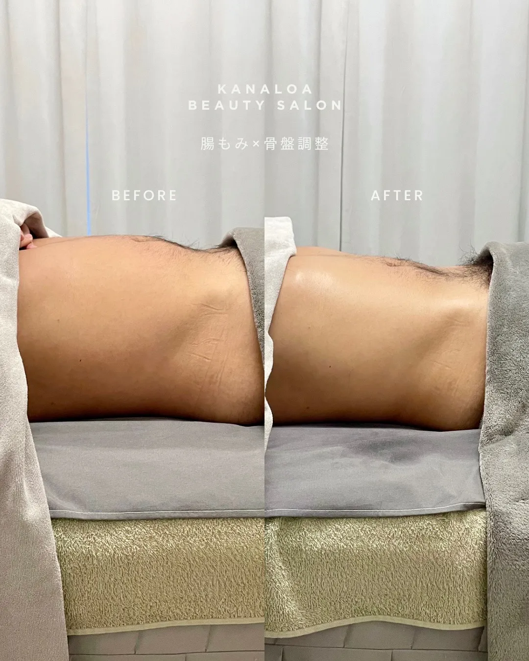 腸もみと食事で名古屋駅で実感するお腹すっきり習慣の始め方