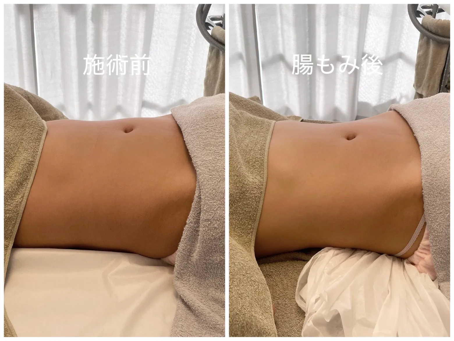 腸もみでお腹集中ケアを叶える名古屋駅周辺の効果的な方法と骨盤調整の魅力解説